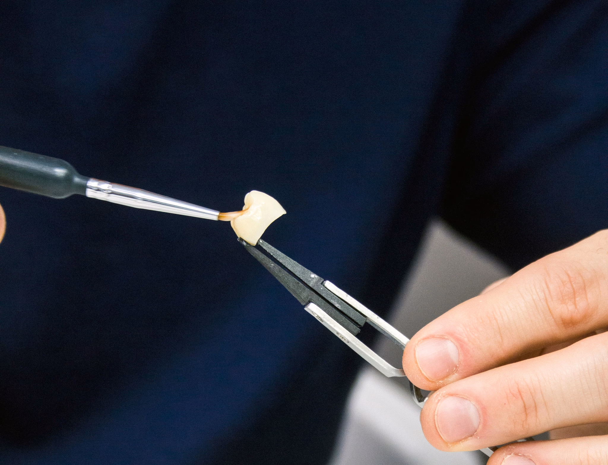 In-house dental lab at Meadowbrook Dental