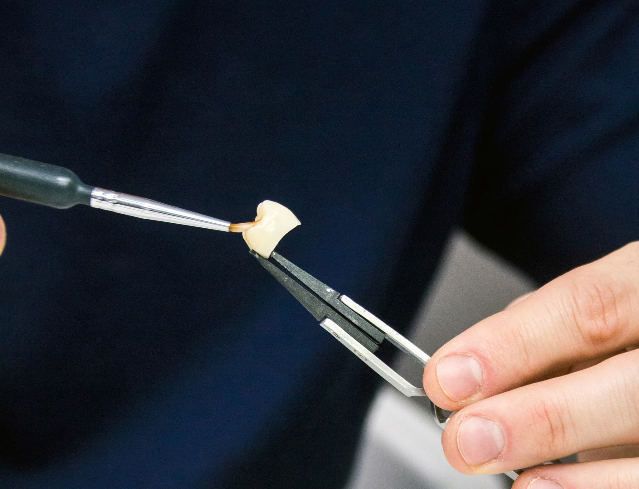 In-house dental lab at Meadowbrook Dental
