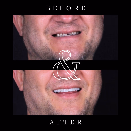 Before and after smile transformation 4