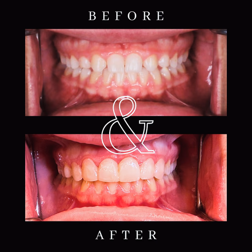 Before and after smile transformation 5
