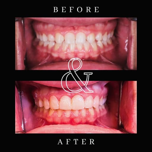 Before and after smile transformation 5