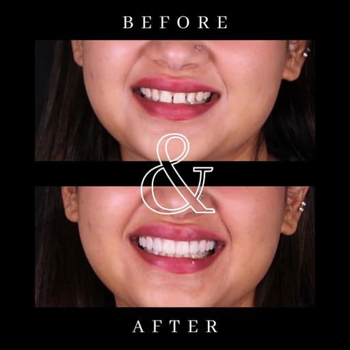 Before and after smile transformation 6
